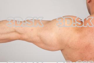 Arm texture of Gene 0002